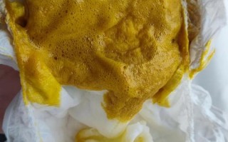 新生儿大便有泡沫是消化不良还是感染？需要就医吗？
