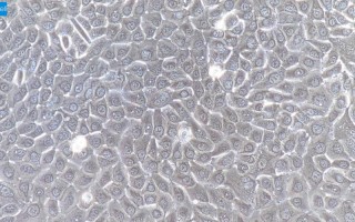 新生儿的小肠上皮细胞