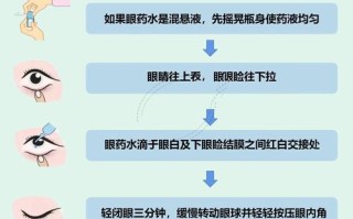 如何给新生儿滴眼药水