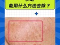 孕期长斑真的能去掉吗？有哪些安全有效的方法可以改善？