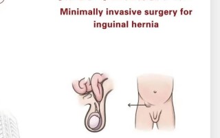 儿童疝气术后家长该如何护理？有哪些注意事项需特别注意？