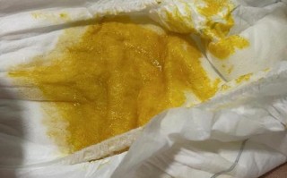 新生儿吃完奶就拉屎是消化不良还是正常生理反应？