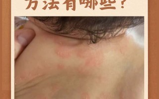 儿童身上反复发痒，是过敏、寄生虫还是其他健康问题？