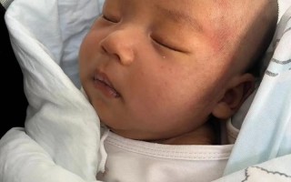 新生儿一个月了黄疸还没退，正常吗？需要怎么处理？