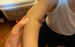 新生儿左胳膊抬不起来