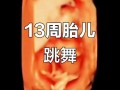 孕期13周胎儿会动吗？这时候的胎动感觉是怎样的？
