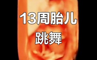 孕期13周胎儿会动吗？这时候的胎动感觉是怎样的？