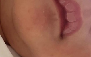 新生儿嘴唇颜色异常是健康预警信号吗？正常该是什么样？