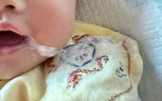 新生儿吐奶是黄绿色的