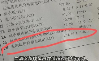 儿童血清淀粉样蛋白升高是严重感染信号还是其他疾病在作祟？