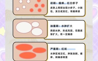 儿童红疙瘩痒是过敏还是皮肤病？