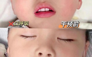 新生儿呼吸时头部轻微一点一点是正常现象吗？需要警惕哪些异常情况？