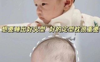 新生儿老是喜欢歪头睡