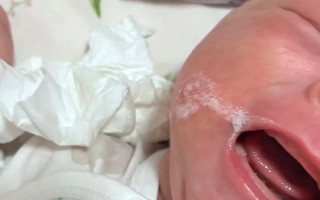 新生儿鼻子溢奶是正常现象吗？需要担心或处理吗？