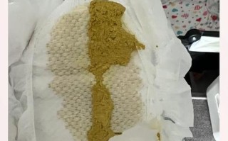 新生儿水便分离是腹泻吗？崔玉涛教你如何区分正常与异常便便？