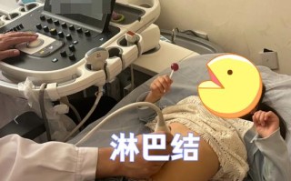 儿童腹腔多发淋巴结肿大是严重疾病吗？需要哪些检查和治疗？