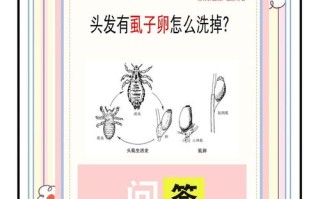 儿童头上长虱子怎么办？有哪些安全有效的除虱方法和家庭护理技巧？