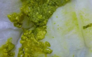 新生儿吃益生菌后拉绿便，是正常反应还是需要停用益生菌？