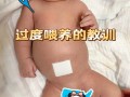 新生儿肚子咕咕叫还哭闹，是肠胀气还是消化不良？