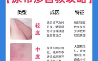 新生儿泌尿系统感染有哪些容易被忽视的异常表现？