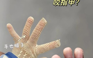 儿童咬指甲的坏习惯，到底该如何有效治疗与纠正呢？