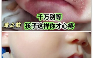 儿童唇膏孕妇能放心用吗？成分安全性和适用性需注意什么？