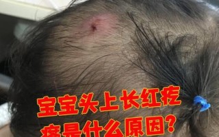 新生儿毛囊炎症状图片有哪些典型表现？如何区分与其他皮肤问题？