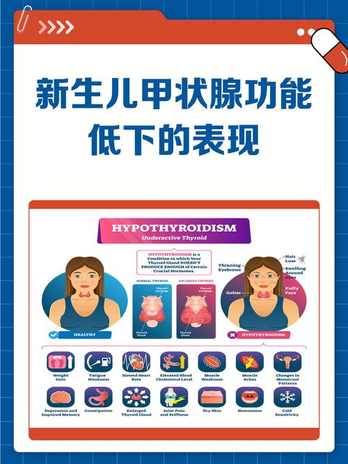 新生儿甲低症状有哪些？-第1张图片-中州医学会