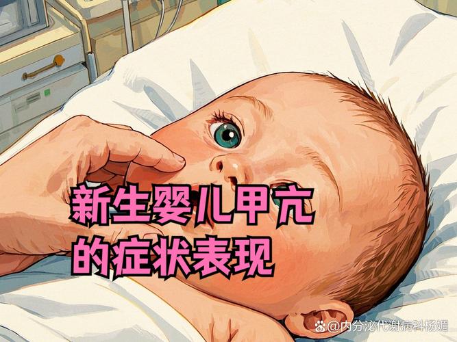新生儿甲低症状有哪些？-第3张图片-中州医学会