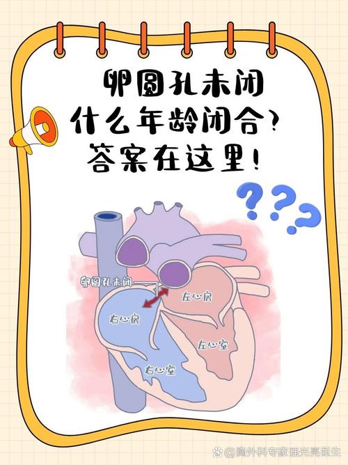 新生儿动脉导管、卵圆孔未闭,要干预吗?-第2张图片-中州医学会 新生儿动脉导管、卵圆孔未闭,要干预吗?-第2张图片-中州医学会