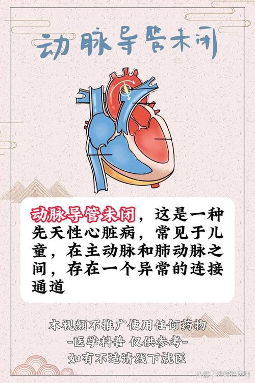 新生儿动脉导管、卵圆孔未闭,要干预吗?-第1张图片-中州医学会 新生儿动脉导管、卵圆孔未闭,要干预吗?-第1张图片-中州医学会