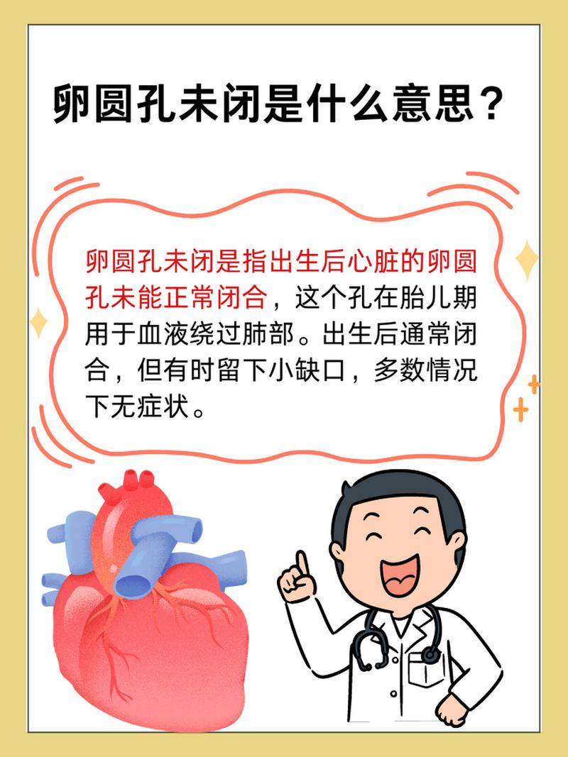 新生儿动脉导管、卵圆孔未闭，要干预吗？-第3张图片-中州医学会