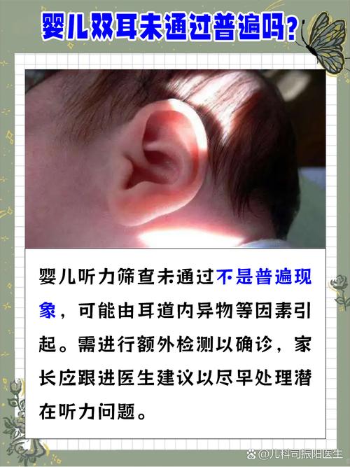 新生儿双耳未通过听力筛查怎么办？-第3张图片-中州医学会