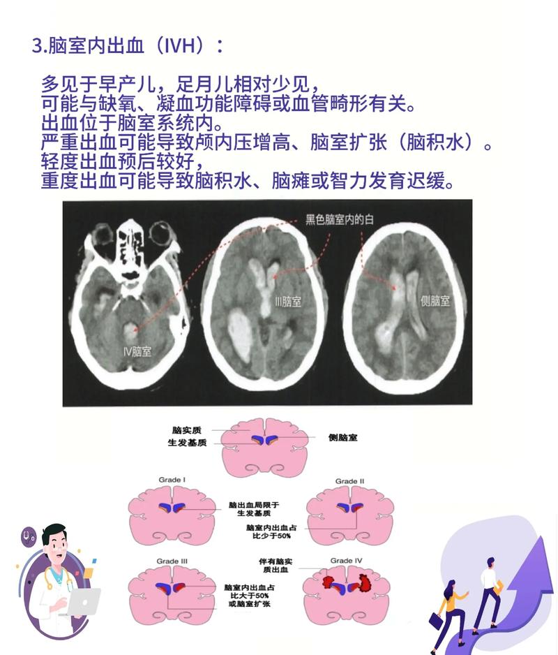 如何有效预防新生儿颅内出血？-第2张图片-中州医学会
