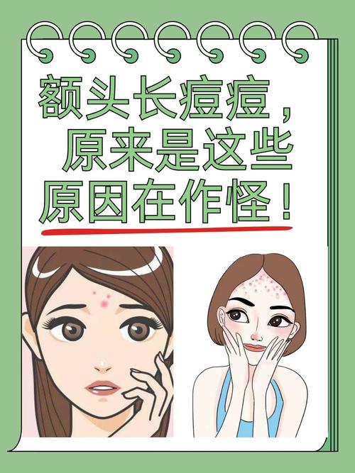 孕期额头长痘是激素变化还是其他原因？-第2张图片-中州医学会