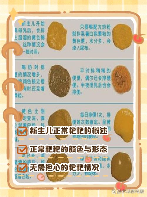 新生儿两天没大便奶粉喂养正常吗？-第1张图片-中州医学会