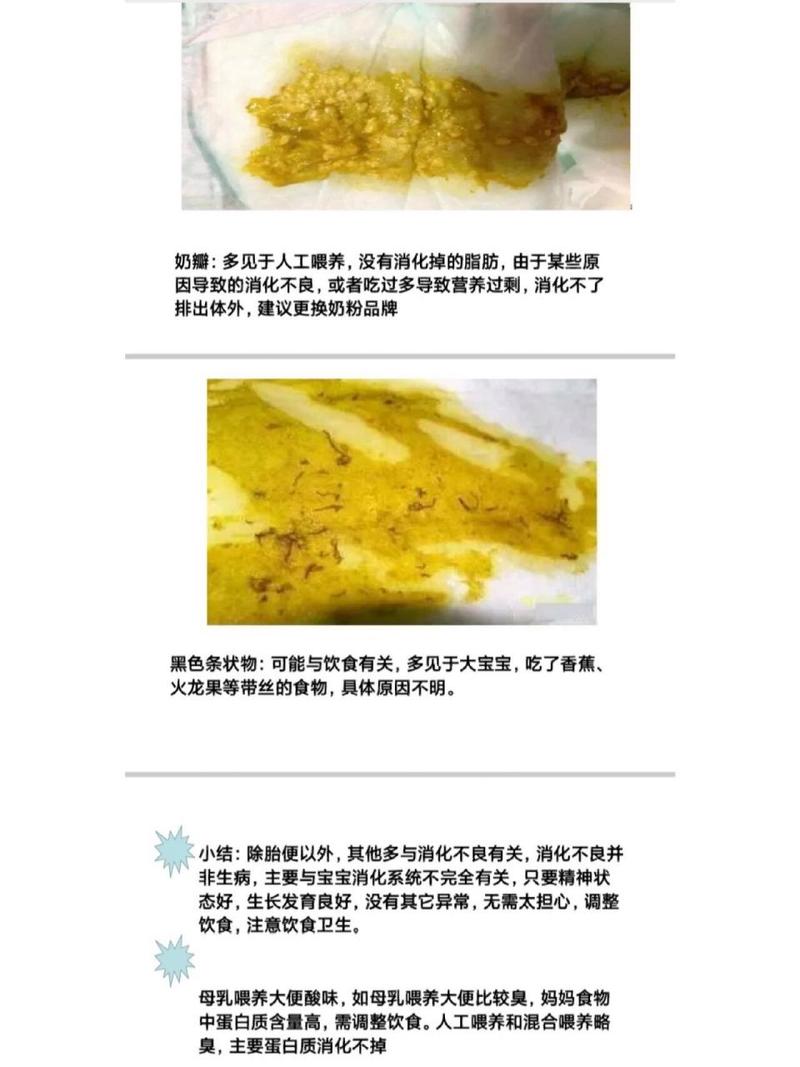 新生儿两天没大便奶粉喂养正常吗？-第2张图片-中州医学会