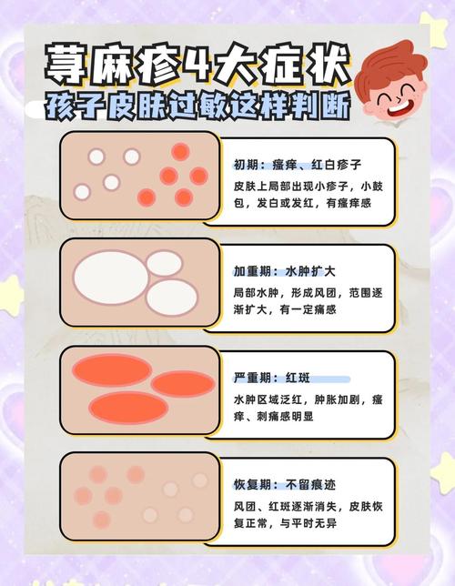 儿童红疙瘩痒是过敏还是皮肤病？-第1张图片-中州医学会