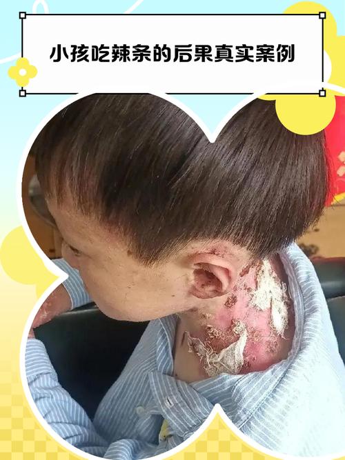 孕期吃辣条会影响胎儿吗？-第1张图片-中州医学会