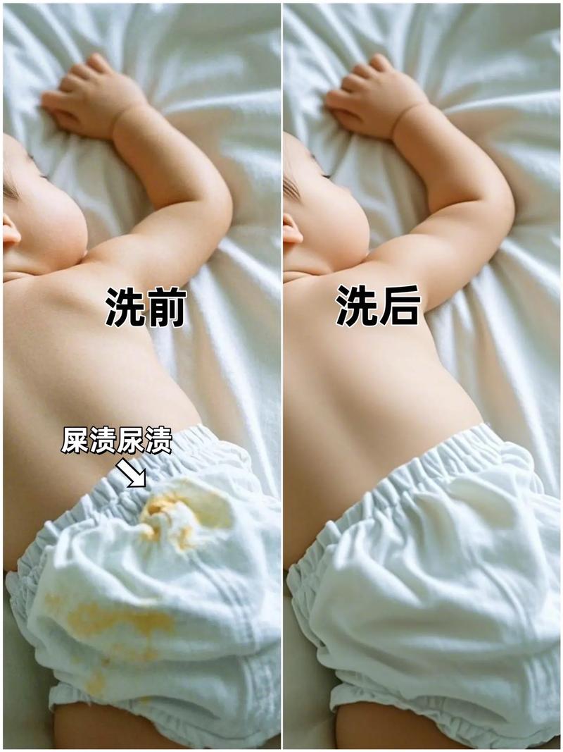 新生儿衣服洗衣粉洗有害吗？-第3张图片-中州医学会