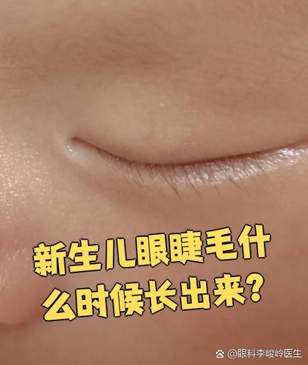 新生儿眼睫毛何时长出?-第2张图片-中州医学会 新生儿眼睫毛何时长出?-第2张图片-中州医学会