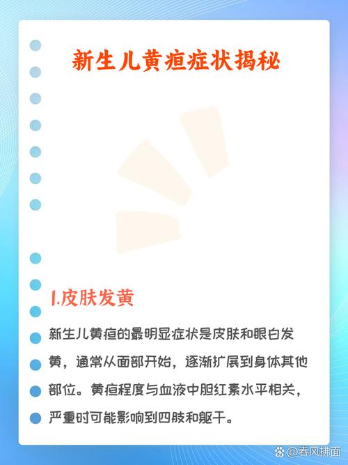新生儿眼白发黄是黄疸吗？-第2张图片-中州医学会