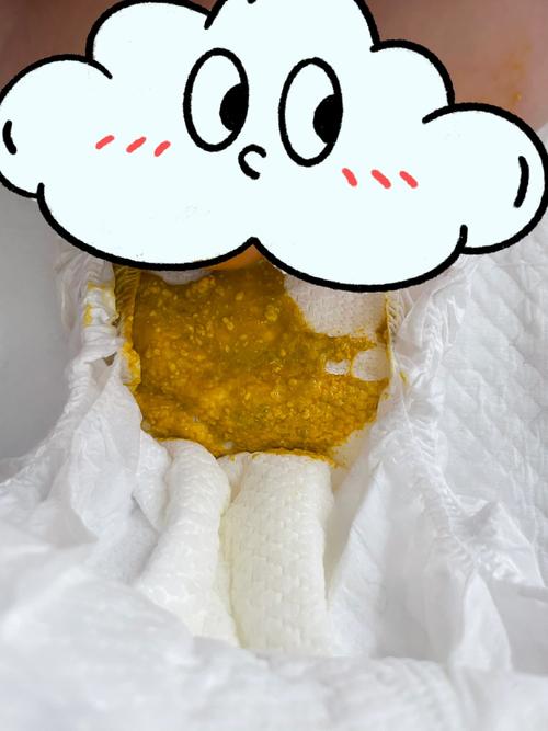 10岁儿童一周一次大便正常吗？-第2张图片-中州医学会