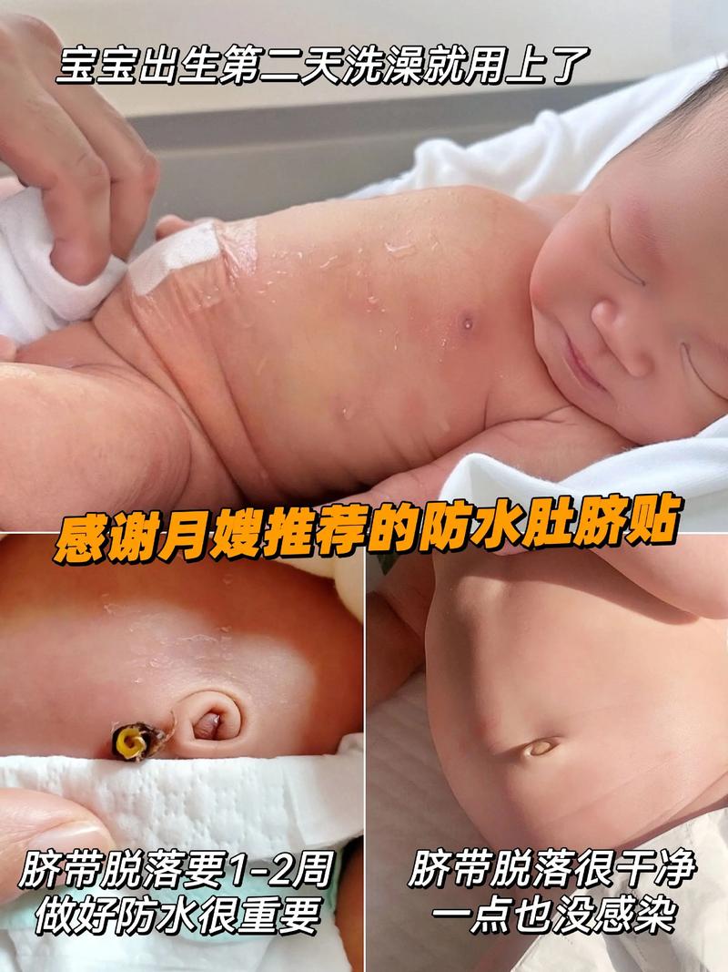 新生儿肚脐脱落后多久能碰水？-第2张图片-中州医学会