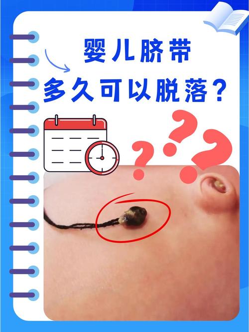 新生儿肚脐脱落后多久能碰水？-第1张图片-中州医学会