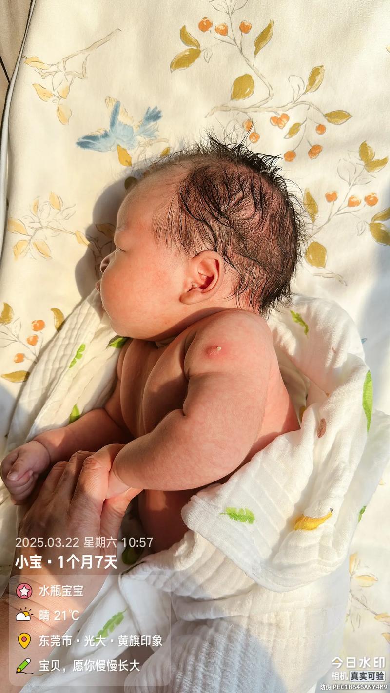 新生儿种花后脓包破了咋处理？-第2张图片-中州医学会