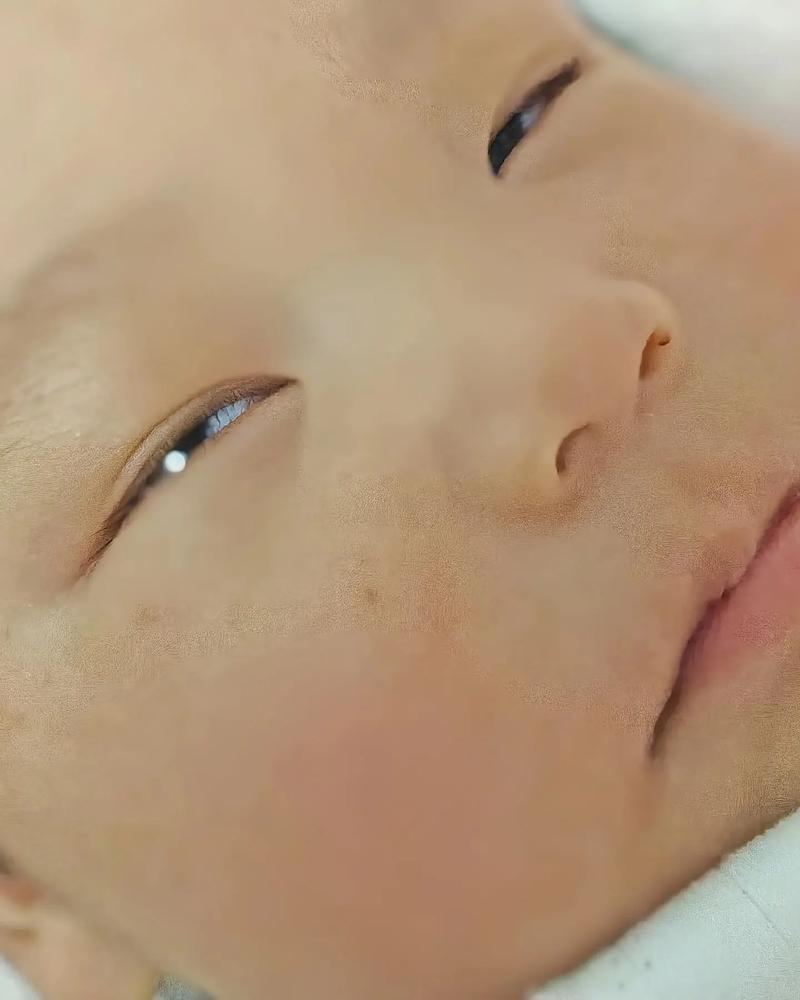 新生儿眼睛多久才能完全睁开?-第2张图片-中州医学会 新生儿眼睛多久才能完全睁开?-第2张图片-中州医学会