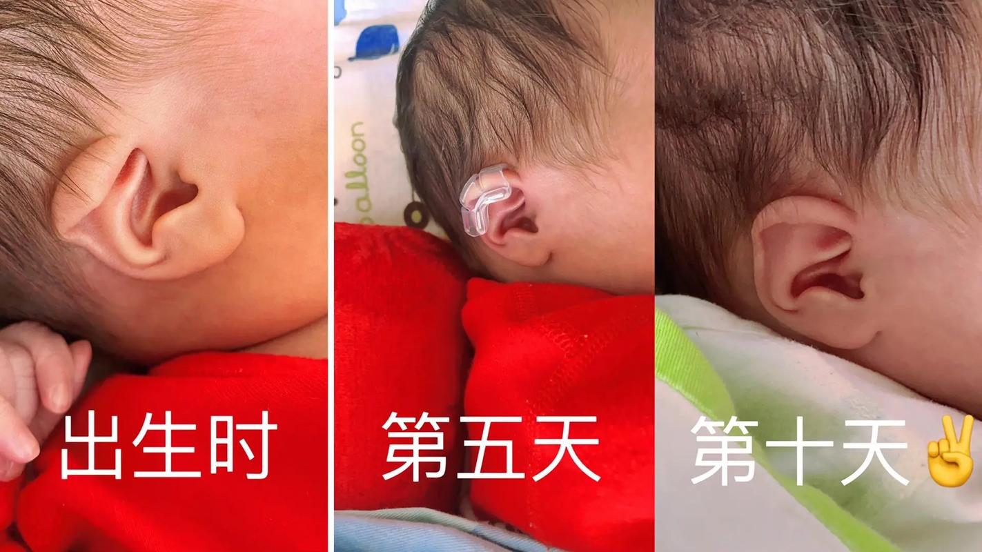 新生儿何时能看见听见？感官发育时间点-第2张图片-中州医学会