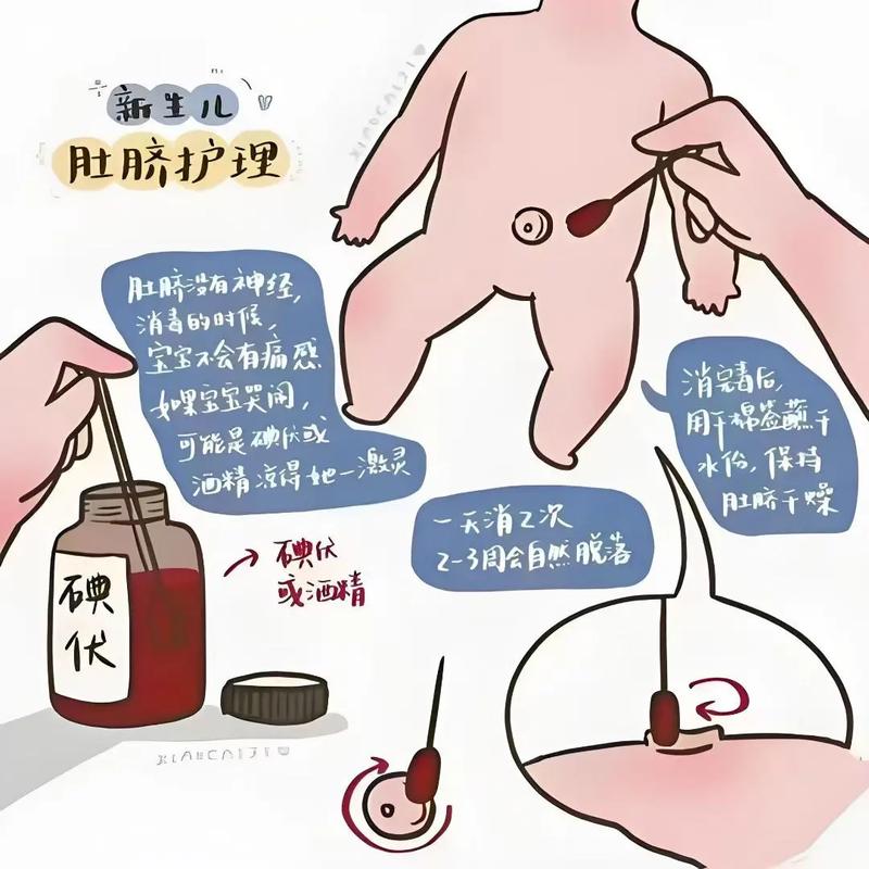 脐带脱落后护理要注意什么？-第3张图片-中州医学会
