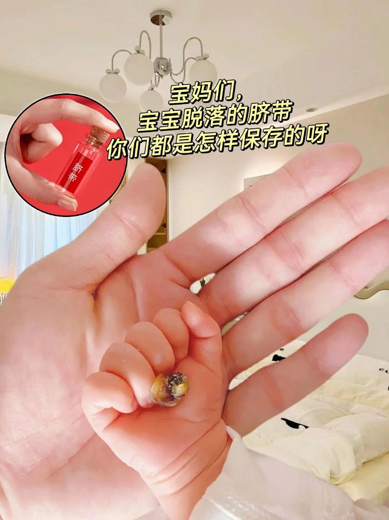 新生儿脐带脱落后多久能沾水？-第1张图片-中州医学会